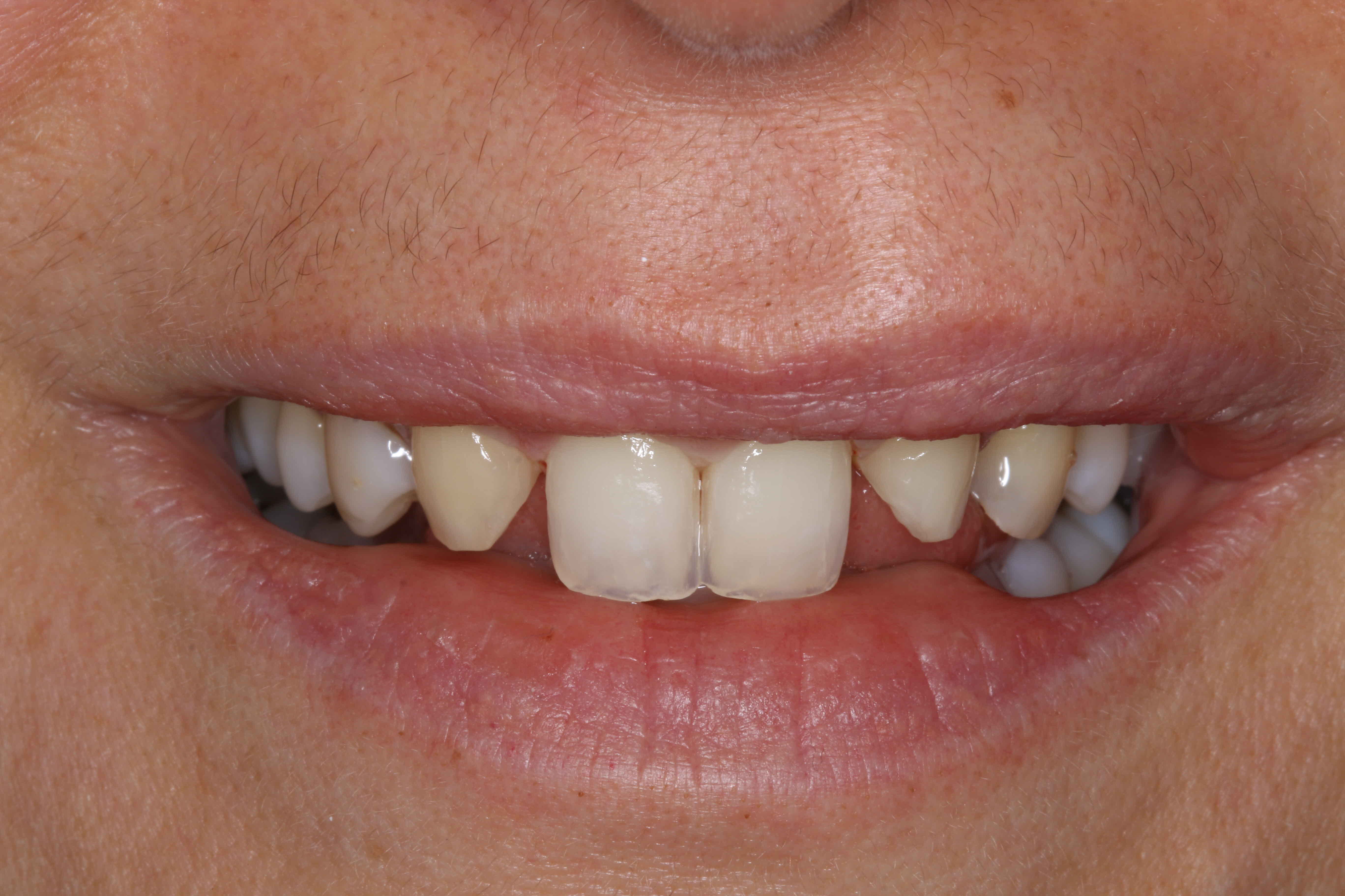 orthodontics or cosmetic dentistry