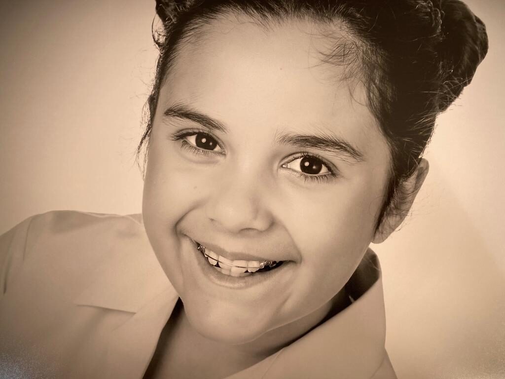 early intervention orthodontics early intervention orthodontics
