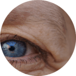 Brow Lift Facial Aesthetics