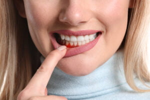 General Health And Dental Health Gum disease