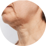 sagging skin sagging skin