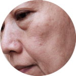 tired skin skin boosters