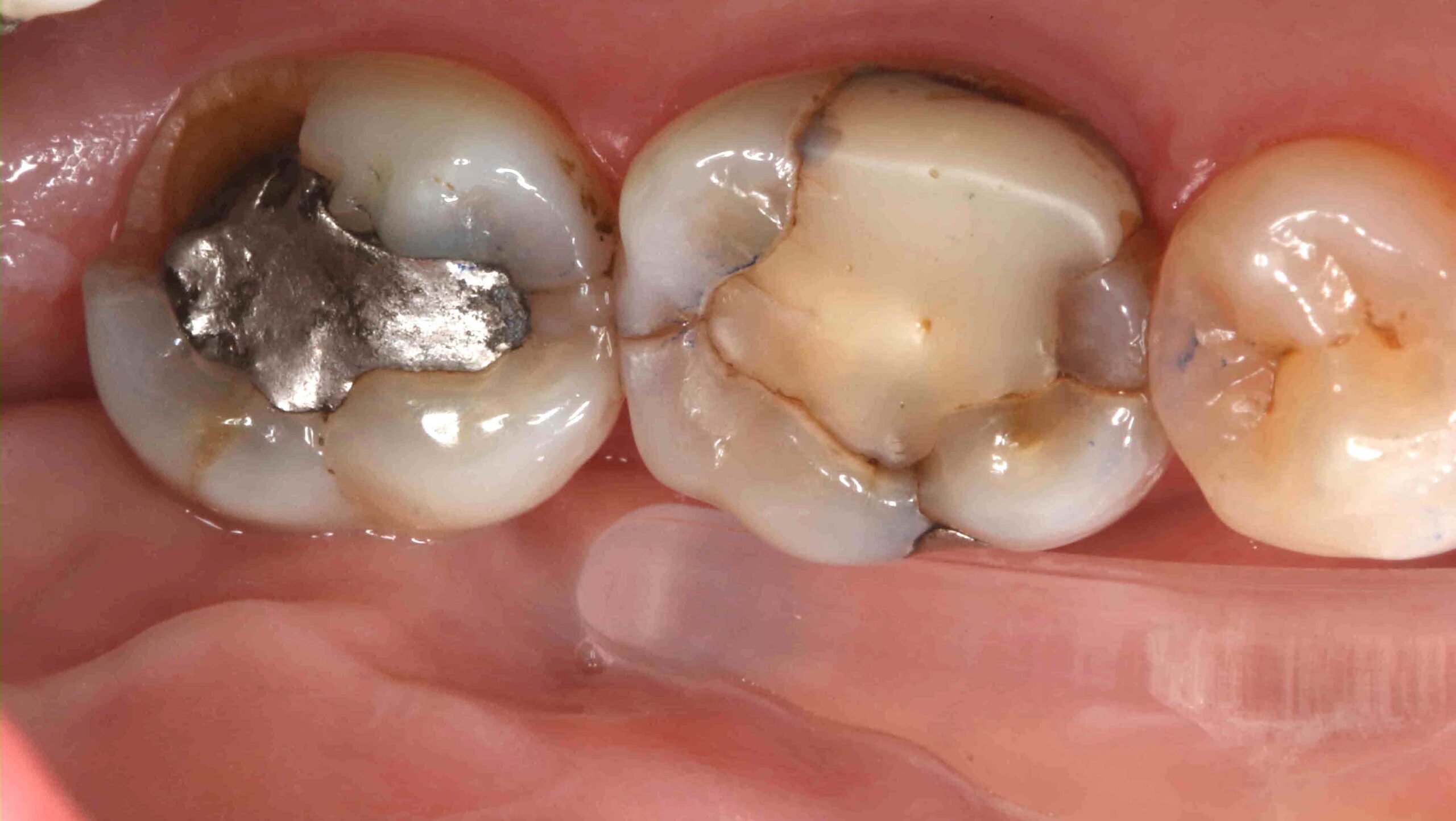 Restorative Dentistry